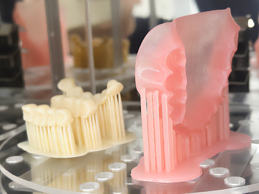 3Dスキャンなどのデジタル技術を活用して設計・製作するデジタルデンチャー